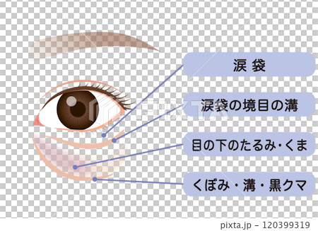 目の下のたるみ たるんだ下まぶた 目の下のたるみ たるんだ下まぶた 120399319