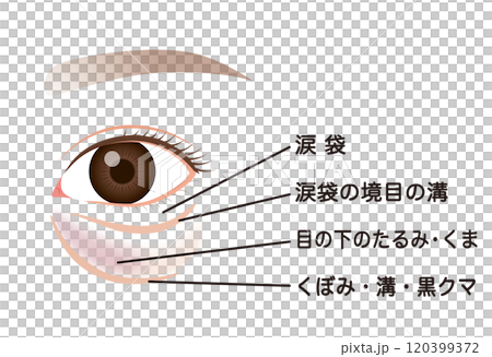 目の下のたるみ　たるんだ下まぶた 120399372