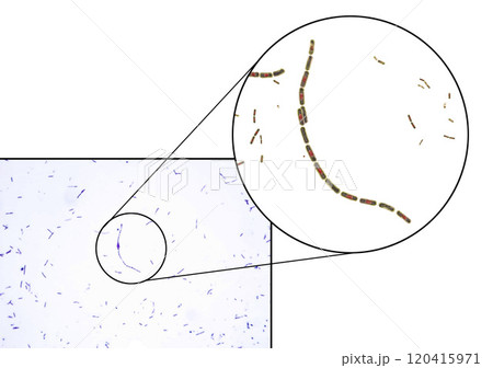 Bacteria Bacillus anthracis 120415971