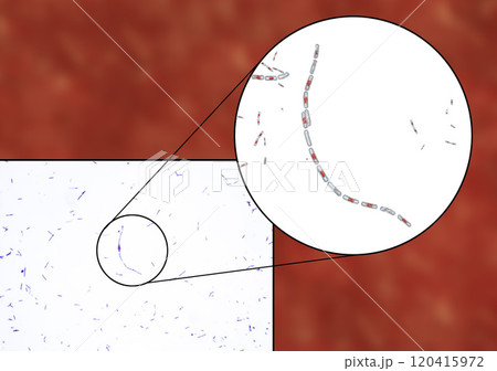 Bacteria Bacillus anthracis Bacteria Bacillus anthracis 120415972