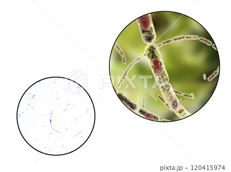 Bacillus anthracis, light micrograph and illustration Bacillus anthracis, light micrograph and illustration 120415974