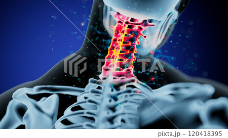 Vibrant Cervical Vertebrae: A Stunning Glow on Human Spine Anatomy 120418395