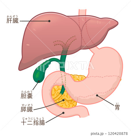 胆道ドレナージのイラスト、Biliary Drainage 120420878