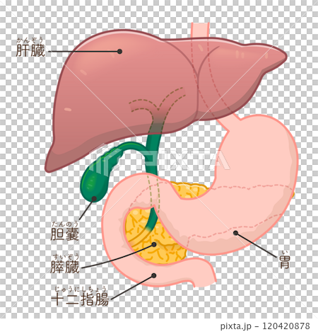 胆道ドレナージのイラスト、Biliary Drainage 120420878