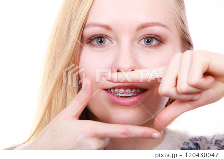 Happy woman showing her braces on teeth 120430047