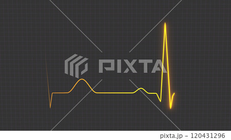 Normal heart rhythm ECG electrocardiogram of a healthy person, heart examination method Normal heart rhythm ECG electrocardiogram of a healthy person, heart examination method 120431296