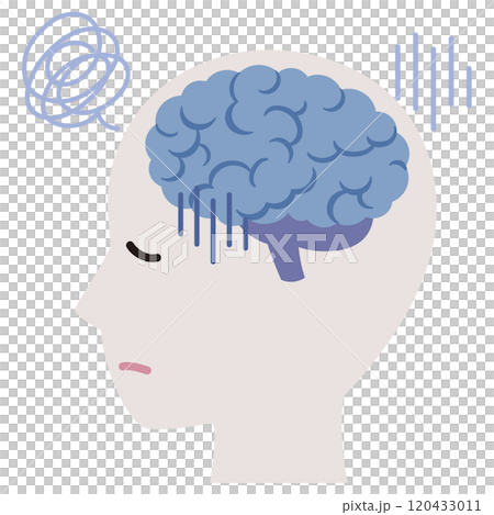 腦部壓力/疲勞 120433011