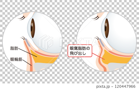 Sagging under the eyes: Firm eyes and sagging eyes Sagging under the eyes: Firm eyes and sagging eyes 120447966