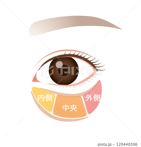 眼窩脂肪　目の下のたるみ　たるんだ下まぶた 120448306