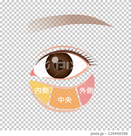 眼窩脂肪　目の下のたるみ　たるんだ下まぶた 120448306