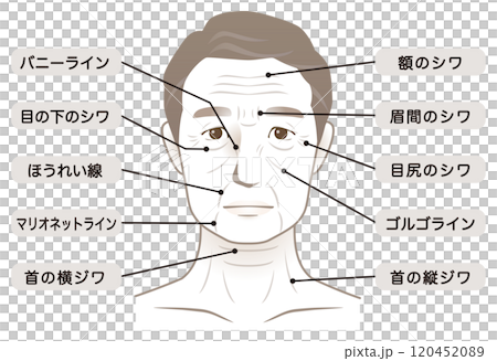 高齢男性の顔　シワ　名称　美容　老化 120452089