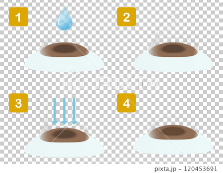 Illustration showing the procedure for vision correction surgery Illustration showing the procedure for vision correction surgery 120453691
