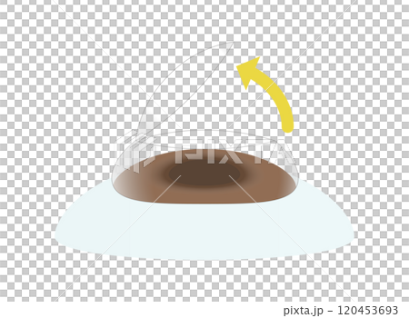 Illustration of opening a corneal flap in vision correction surgery 120453693