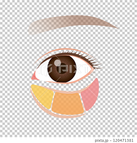 Orbital fat, bags under the eyes, sagging lower eyelids 120471381