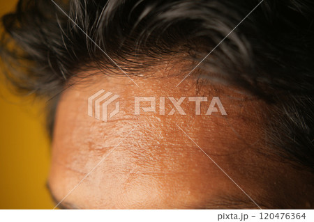 closeup of sweat on forehead against dark background , 120476364