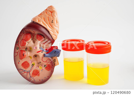 Urinalysis, Kidney and urine cup for check health examination in laboratory. Urinalysis, Kidney and urine cup for check health examination in laboratory. 120490680