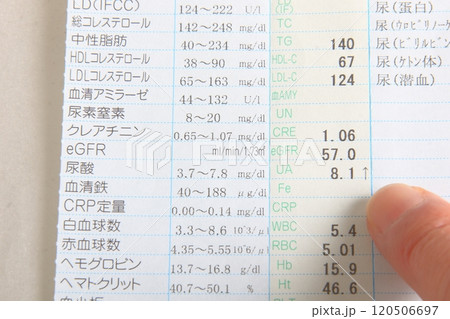 健康診断結果 尿酸値高値 健康診断結果 尿酸値高値 120506697