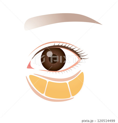 眼窩脂肪 目の下のたるみ たるんだ下まぶた 眼窩脂肪 目の下のたるみ たるんだ下まぶた 120514499