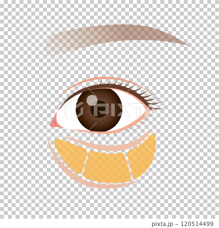 眼窩脂肪 目の下のたるみ たるんだ下まぶた 眼窩脂肪 目の下のたるみ たるんだ下まぶた 120514499