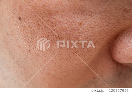 頬の毛穴拡大写真:肌悩みにフォーカス(30代男性) 頬の毛穴拡大写真:肌悩みにフォーカス(30代男性) 120537995