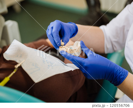 Dentist examining a dental mold for precise treatment planning during patient consultation Dentist examining a dental mold for precise treatment planning during patient consultation 120556706