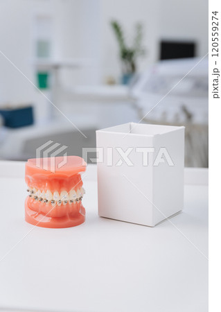 Orthodontic dental model with braces for patient education and treatment planning display Orthodontic dental model with braces for patient education and treatment planning display 120559274