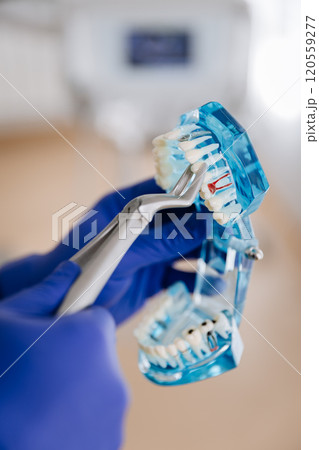 Dentist demonstrating tooth extraction using a transparent jaw model in a clinical setting Dentist demonstrating tooth extraction using a transparent jaw model in a clinical setting 120559277