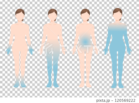 Illustrations of four different realistic body types of women with poor circulation 120569222