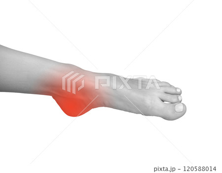 Foot pain with inflamed joint and tendon strain. Symptoms of ache, numbness, or cramp linked to 120588014
