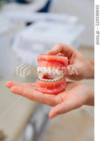 Hand displaying orthodontic teeth model with braces for dental education and oral health care 120590645