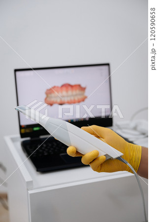 Dentist holding a 3D intraoral scanner with a digital teeth model on a laptop in the background 120590658