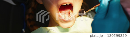 Inspecting Child's Mouth During Dental Examination Inspecting Child's Mouth During Dental Examination 120599229
