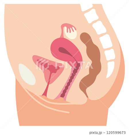 子宮 女性生殖器の断面図 婦人病 医療 子宮 女性生殖器の断面図 婦人病 医療 120599673