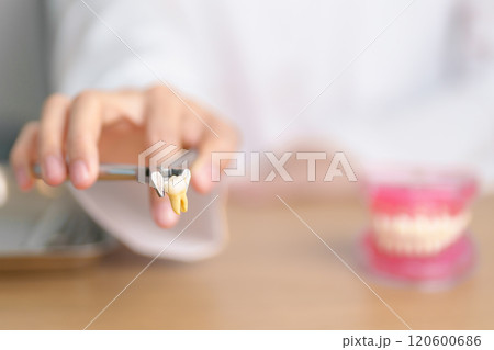 Dentist with tooth Anatomy model. Oral Teeth and disease, Scrape off tartar. March Oral health, Dentist Day, False Teeth. Toothache and Children Dental Health Month and Orthodontic Health Day 120600686
