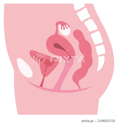 子宮　女性生殖器の断面図　婦人病　医療 120602318
