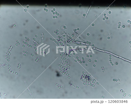 染色していないペニシリウム属の顕微鏡写真 120603846