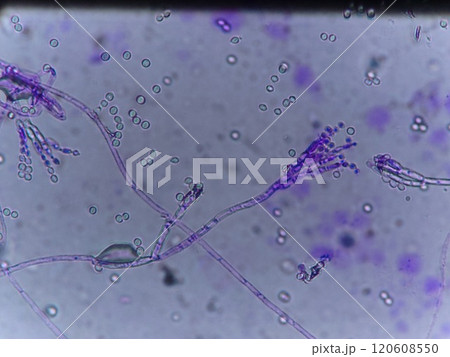 カマンベールチーズの光学顕微鏡 カマンベールチーズの光学顕微鏡 120608550