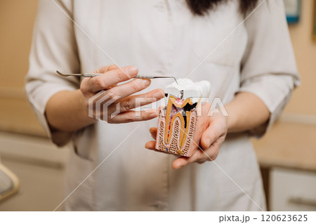 Dentist demonstrating tooth anatomy and cavity treatment with a dental model in a clinic setting 120623625