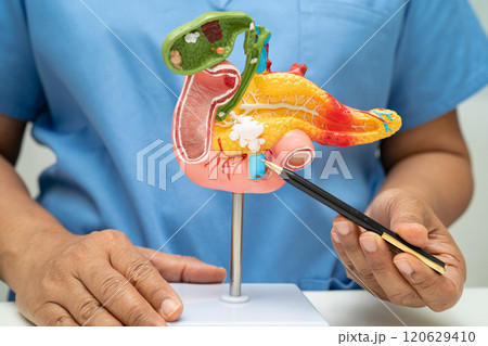 Pancreatitis, pancreatic cancer, Asian doctor with pancreas, gallbladder and bile duct human anatomy model at hospital. Pancreatitis, pancreatic cancer, Asian doctor with pancreas, gallbladder and bile duct human anatomy model at hospital. 120629410