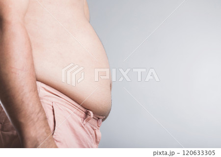 A man with excess weight stands, holding his waistband, indicating potential urinary issues linked to obesity. Highlights the connection between weight-related health problems and men's well being A man with excess weight stands, holding his waistband, indicating potential urinary issues linked to obesity. Highlights the connection between weight-related health problems and men's well being 120633305