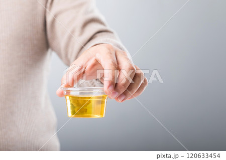 Man holds a clear plastic cup containing a urine sample, emphasizing how urine color can reveal important health insights. A reminder of the role of self-monitoring in maintaining wellness 120633454