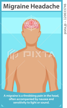 Understanding Migraine Headaches Understanding Migraine Headaches 120633746