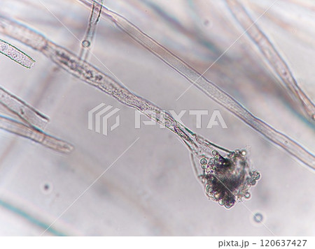 分生子柄の顕微鏡写真 分生子柄の顕微鏡写真 120637427