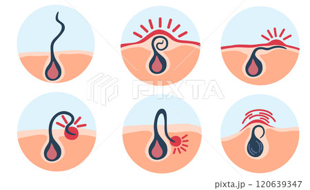 1508_infrown_set 1508_infrown_set 120639347