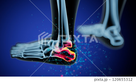 Anatomical Illustration of Ankle Joint with Inflammation Highlight 120655312