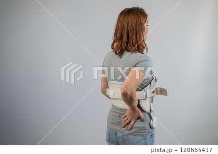 Caucasian woman in a brace after a spinal fracture. Caucasian woman in a brace after a spinal fracture. 120665417