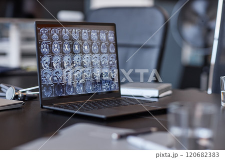 Background shot of neurologists laptop showing computed tomography imaging of human brain on screen resting on conference table in medical office, selective focus, copy space 120682383