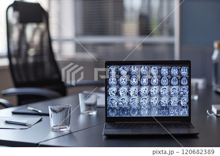 Background shot of X ray scan imaging of patients brain displayed on digital screen connected to laptop on meeting table at neurologists office, copy space Background shot of X ray scan imaging of patients brain displayed on digital screen connected to laptop on meeting table at neurologists office, copy space 120682389