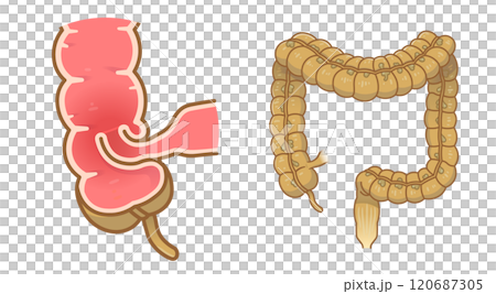 腸套疊，插圖 120687305