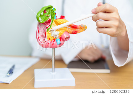 Doctor with human Pancreatitis anatomy model with Pancreas, Gallbladder, Bile Duct, Duodenum, Small intestine and tablet. Pancreatic cancer, acute pancreatitis and Digestive system Doctor with human Pancreatitis anatomy model with Pancreas, Gallbladder, Bile Duct, Duodenum, Small intestine and tablet. Pancreatic cancer, acute pancreatitis and Digestive system 120692323